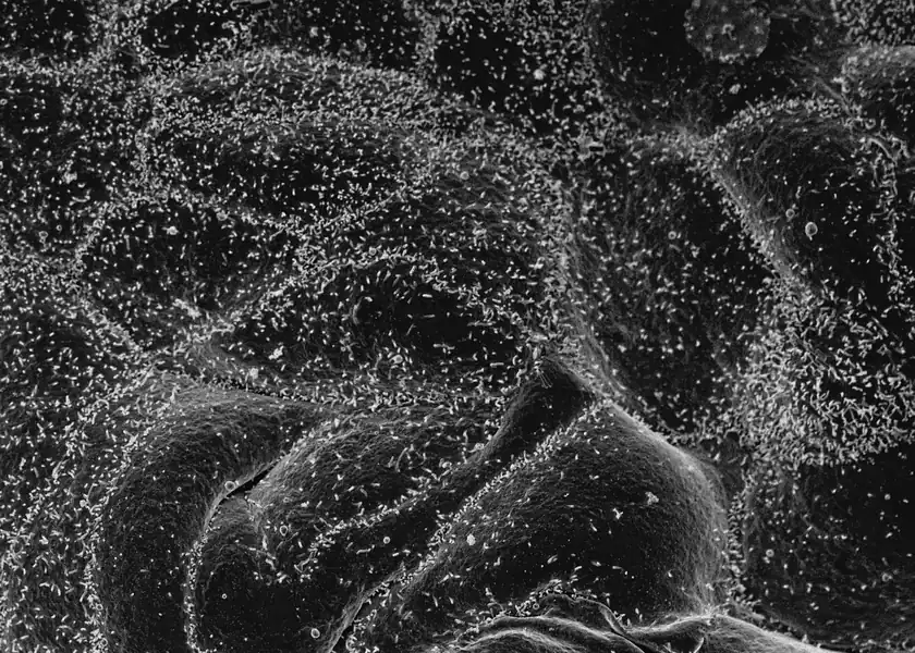 Electron microscope view of a cell surface